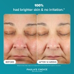 Paula’s Choice C15 Super BOOSTER - Vitamin C Brightening Serum for Face - Anti Aging & Fades Brown Spots - with Vitamin E & Ferulic Acid - All Skin Types - 20 ml - Image 4