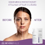 BEVERLY HILLS Instant Facelift Anti Aging Eye Serum - Eye Tightening/Lifting Treatment for Dark Circles, Puffy Eyes, Wrinkles, Under Eye Bags, Fine Lines, and Crows Feet | 120 Days Supply - 30ML - Image 6